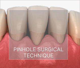 Pinhole Surgical Technique